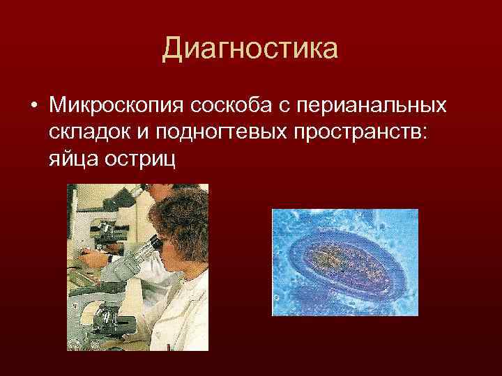 Диагностика • Микроскопия соскоба с перианальных складок и подногтевых пространств: яйца остриц 