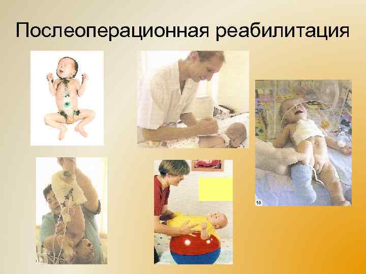 Послеоперационная реабилитация 