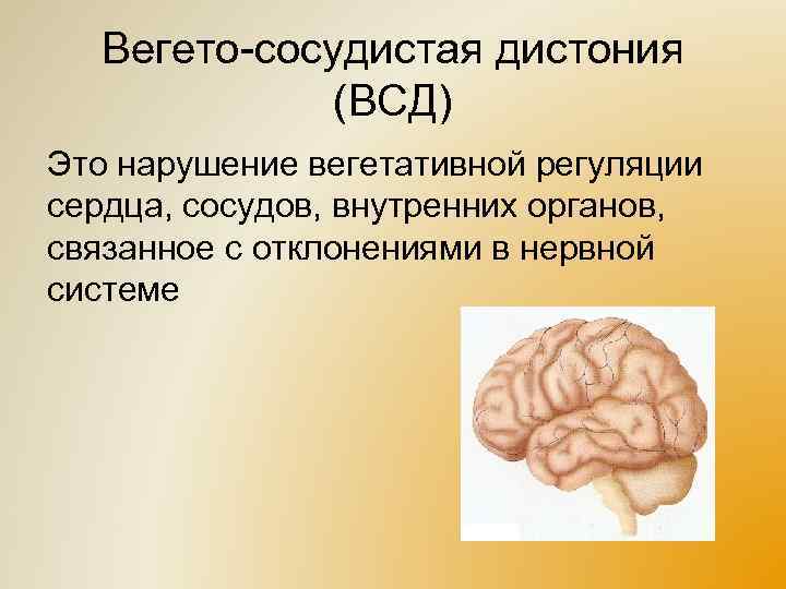 Вегето-сосудистая дистония (ВСД) Это нарушение вегетативной регуляции сердца, сосудов, внутренних органов, связанное с отклонениями