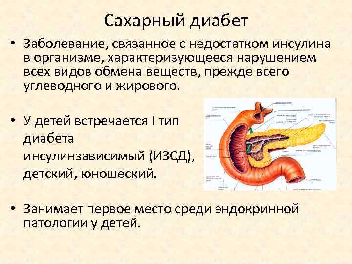 Сахарный диабет • Заболевание, связанное с недостатком инсулина в организме, характеризующееся нарушением всех видов