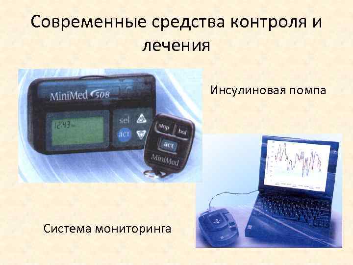 Современные средства контроля и лечения Инсулиновая помпа Система мониторинга 