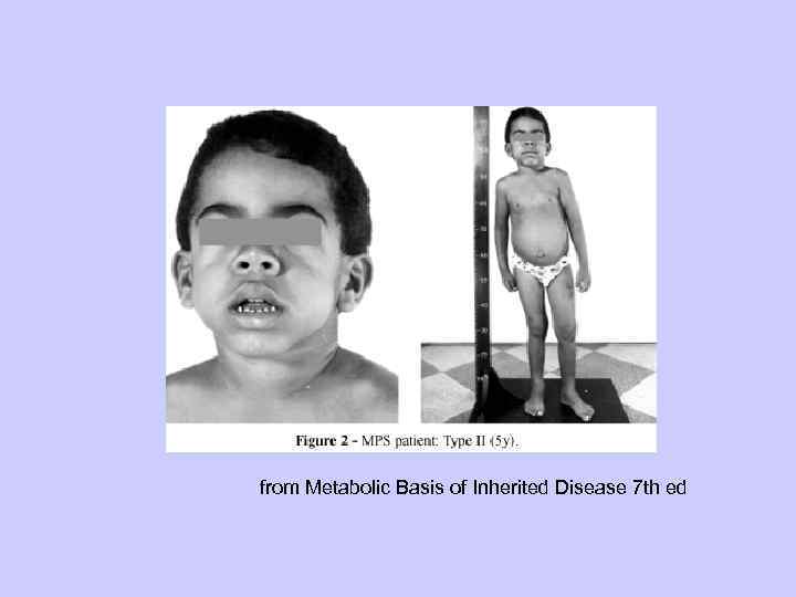 from Metabolic Basis of Inherited Disease 7 th ed 