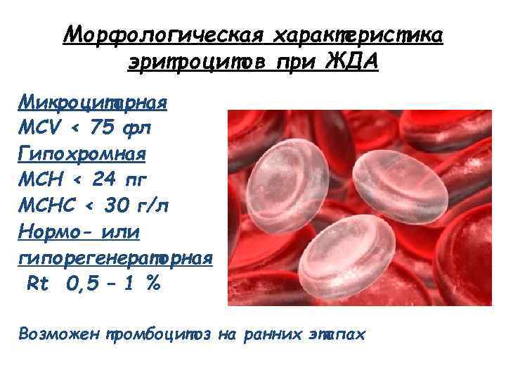 Морфологическая характеристика эритроцитов при ЖДА Микроцитарная MCV < 75 фл Гипохромная MCH < 24