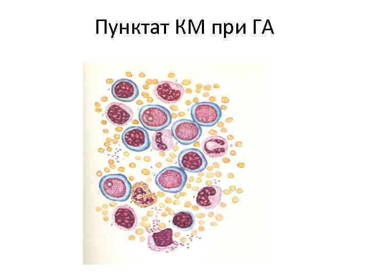 Пунктат КМ при ГА 