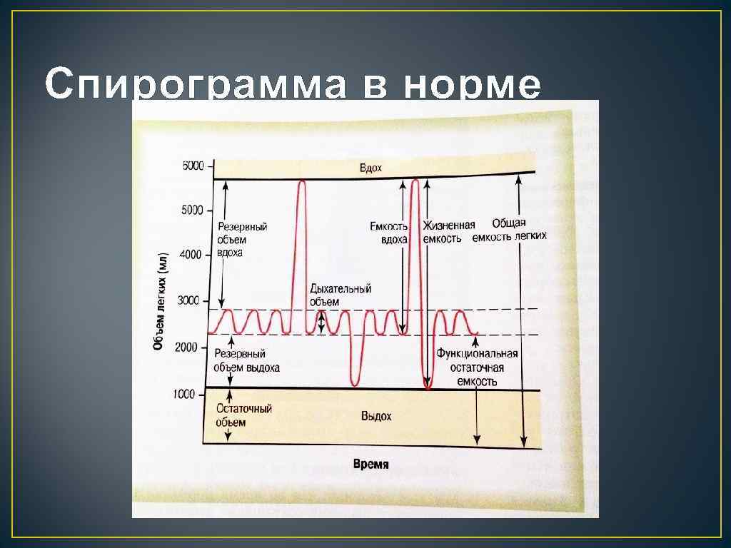 Расшифровка спирографии