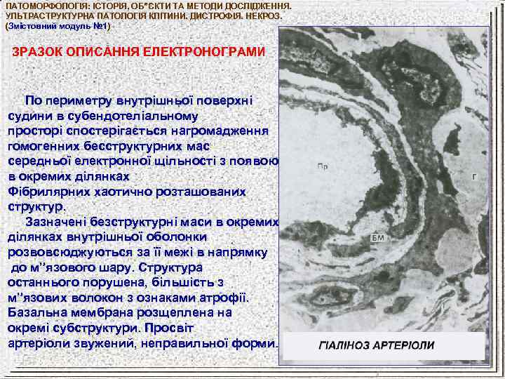 ПАТОМОРФОЛОГІЯ: ІСТОРІЯ, ОБ”ЄКТИ ТА МЕТОДИ ДОСЛІДЖЕННЯ. УЛЬТРАСТРУКТУРНА ПАТОЛОГІЯ КЛІТИНИ. ДИСТРОФІЯ. НЕКРОЗ. (Змістовний модуль №