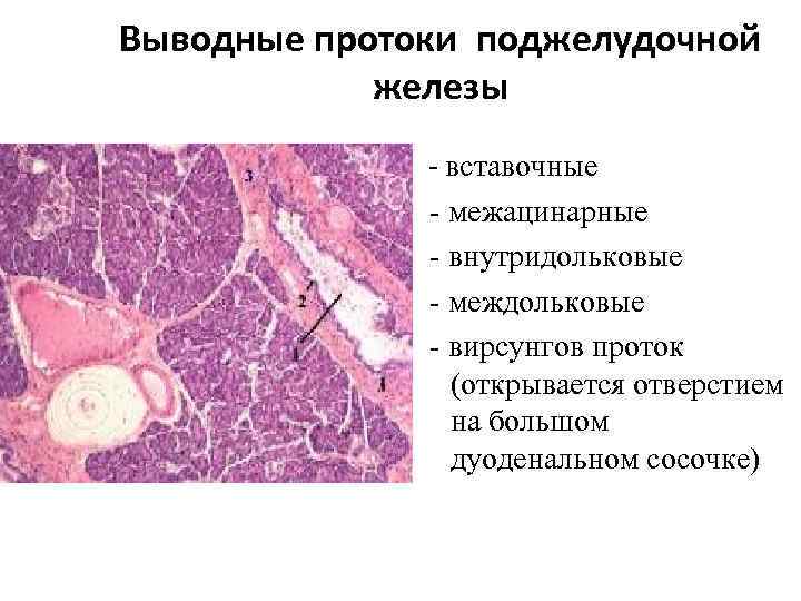 Протоки поджелудочной железы. Выводные протоки поджелудочной железы гистология. Строение выводных протоков поджелудочной железы. Выводной проток поджелудочной железы препараты. Вирсунгов проток гистология.