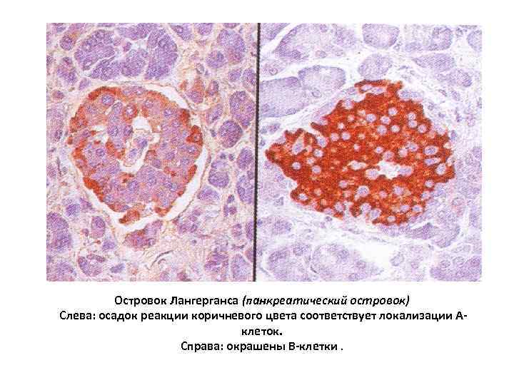 Островок Лангерганса (панкреатический островок) Слева: осадок реакции коричневого цвета соответствует локализации Аклеток. Справа: окрашены