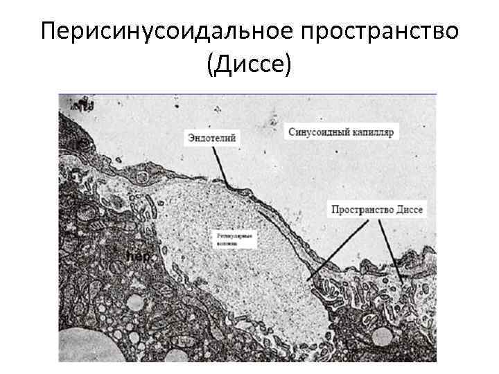 Перисинусоидальное пространство (Диссе) 