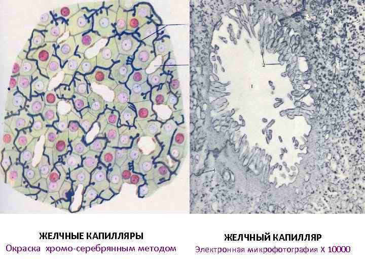 ЖЕЛЧНЫЕ КАПИЛЛЯРЫ Окраска хромо-серебрянным методом ЖЕЛЧНЫй КАПИЛЛЯР Электронная микрофотография X 10000 