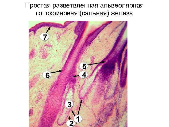 Простая разветвленная альвеолярная голокриновая (сальная) железа 