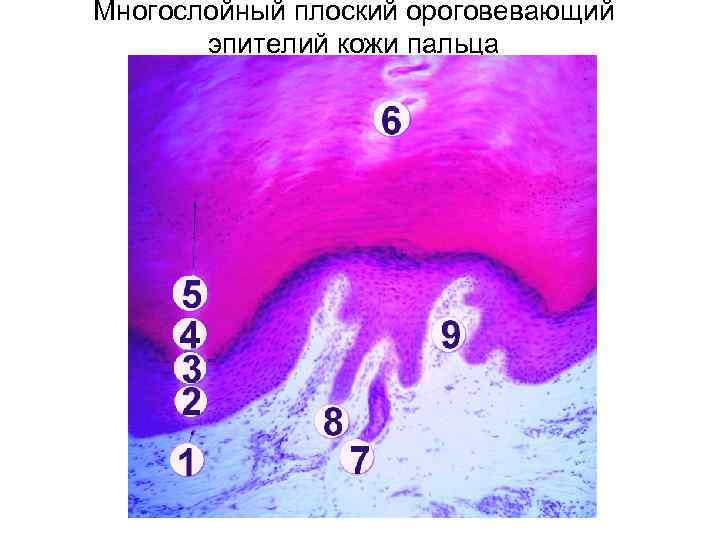 Многослойный плоский ороговевающий эпителий кожи пальца рисунок