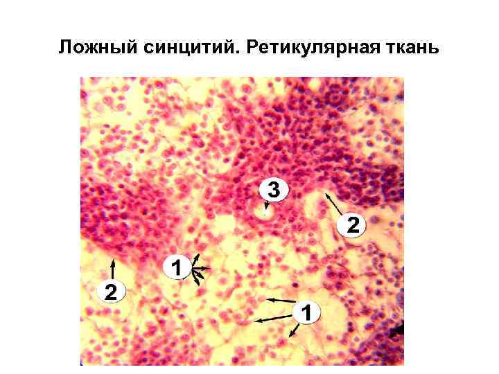 Ложный синцитий. Ретикулярная ткань 