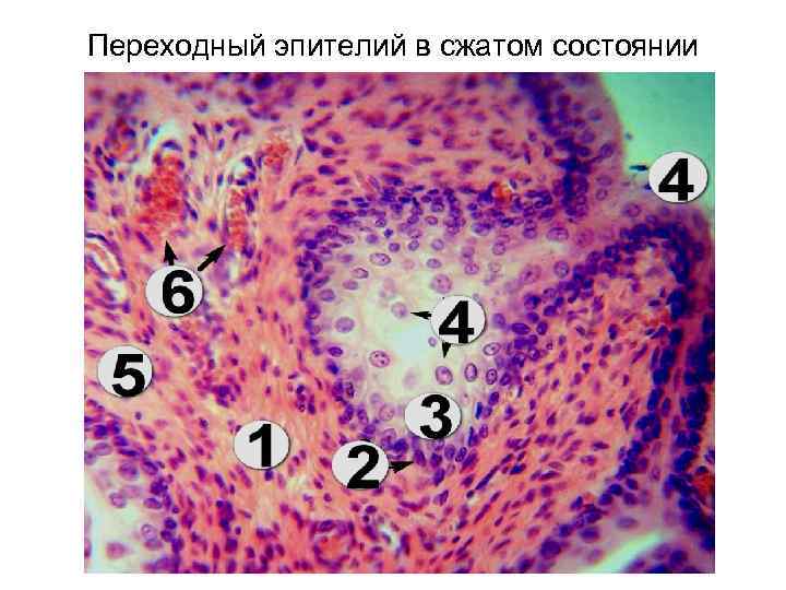 Переходный эпителий в сжатом состоянии 