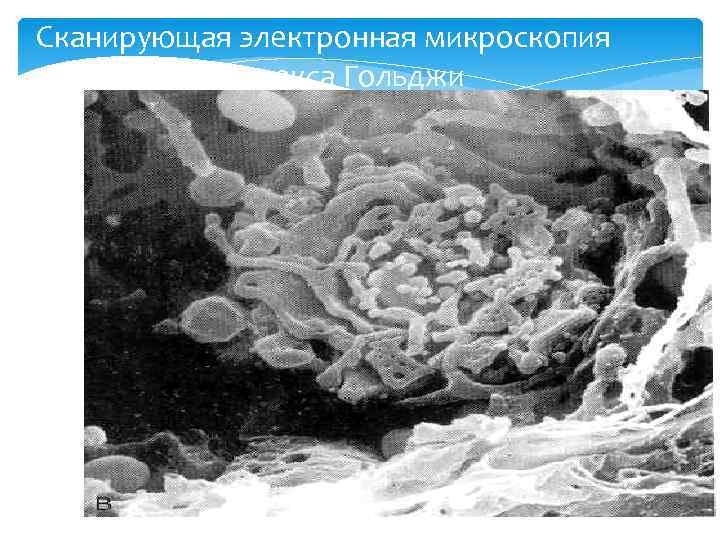 Сканирующая электронная микроскопия Комплекса Гольджи 