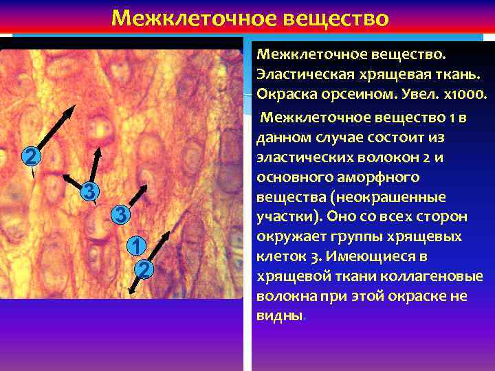 Межклеточное вещество 2 3 3 1 2 Межклеточное вещество. Эластическая хрящевая ткань. Окраска орсеином.