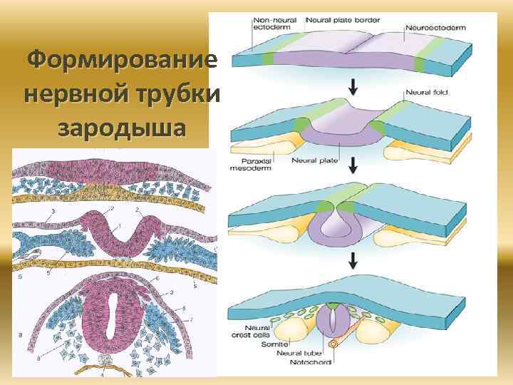 Установите последовательность образование нервной трубки