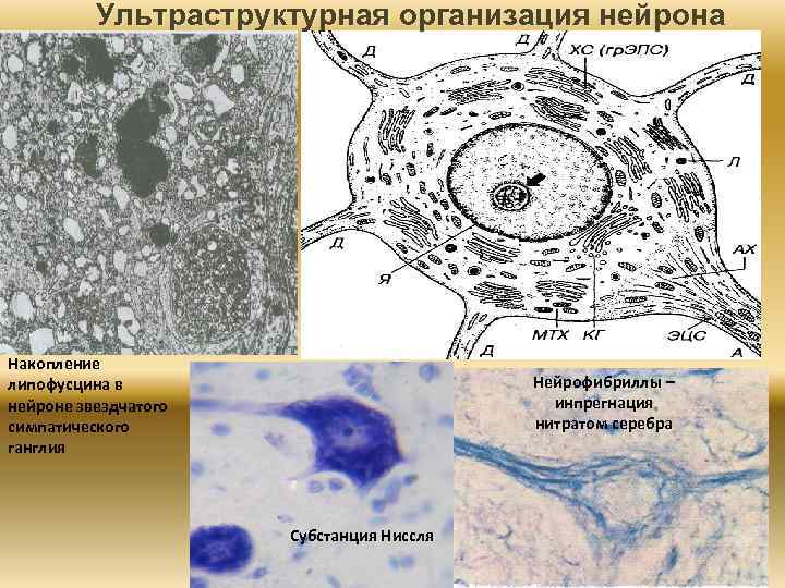 Ультраструктурная организация нейрона Накопление липофусцина в нейроне звездчатого симпатического ганглия Нейрофибриллы – инпрегнация нитратом