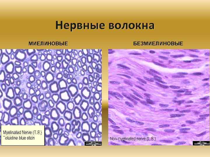 Нервные волокна МИЕЛИНОВЫЕ БЕЗМИЕЛИНОВЫЕ 