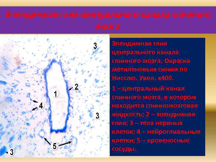 Эпендимная глия центрального канала спинного мозга. Окраска метиленовым синим по Нисслю. Увел. х400. 1