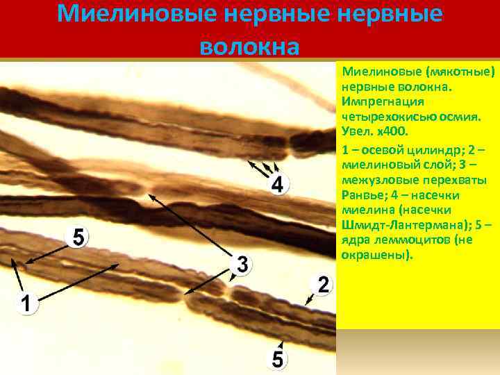 Миелиновые нервные волокна Миелиновые (мякотные) нервные волокна. Импрегнация четырехокисью осмия. Увел. х400. 1 –