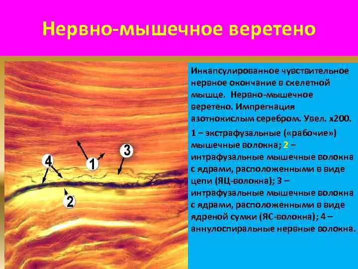 Нервно-мышечное веретено Инкапсулированное чувствительное нервное окончание в скелетной мышце. Нервно-мышечное веретено. Импрегнация азотнокислым серебром.