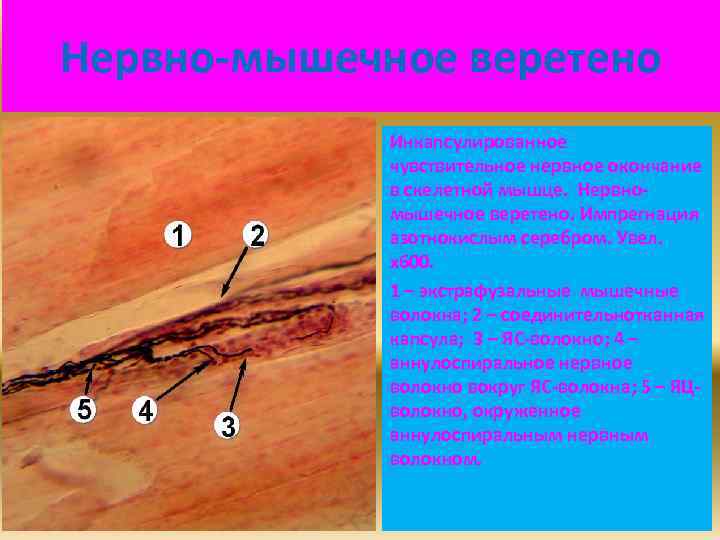 Нервно-мышечное веретено Инкапсулированное чувствительное нервное окончание в скелетной мышце. Нервномышечное веретено. Импрегнация азотнокислым серебром.