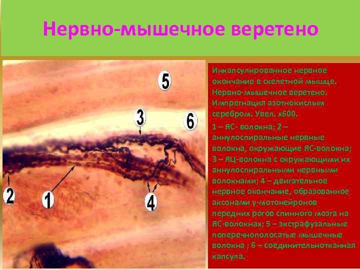 Нервно-мышечное веретено Инкапсулированное нервное окончание в скелетной мышце. Нервно-мышечное веретено. Импрегнация азотнокислым серебром. Увел.
