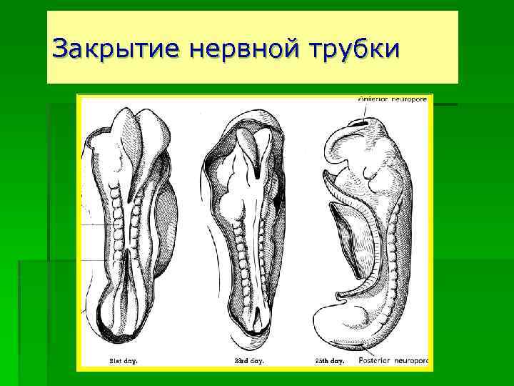 Закрытие нервной трубки 