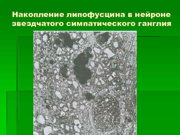 Накопление липофусцина в нейроне звездчатого симпатического ганглия 