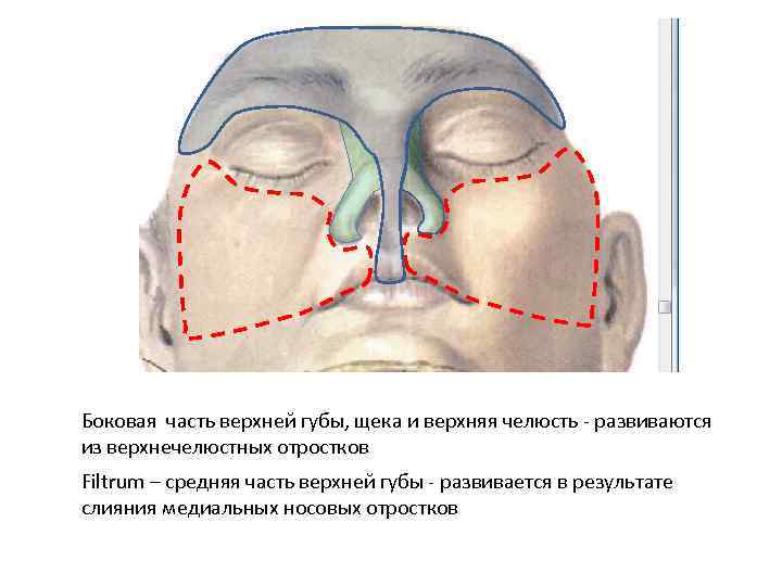 Боковая часть верхней губы, щека и верхняя челюсть - развиваются из верхнечелюстных отростков Filtrum