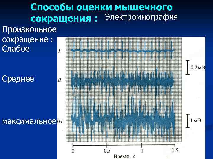 Способы оценки мышечного сокращения : Электромиография Произвольное сокращение : Слабое Среднее максимальное 