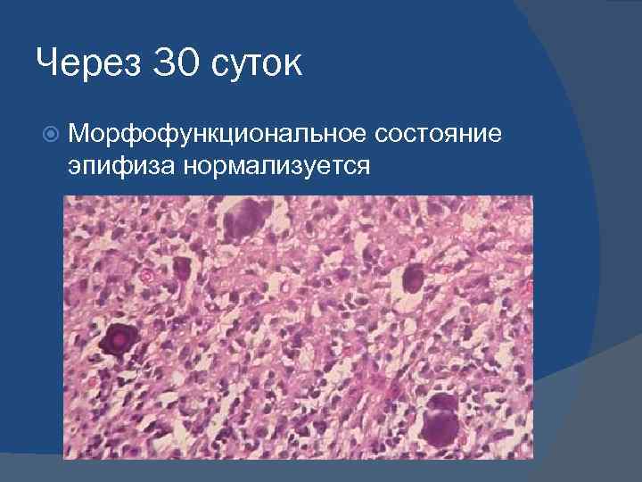 Через 30 суток Морфофункциональное состояние эпифиза нормализуется 