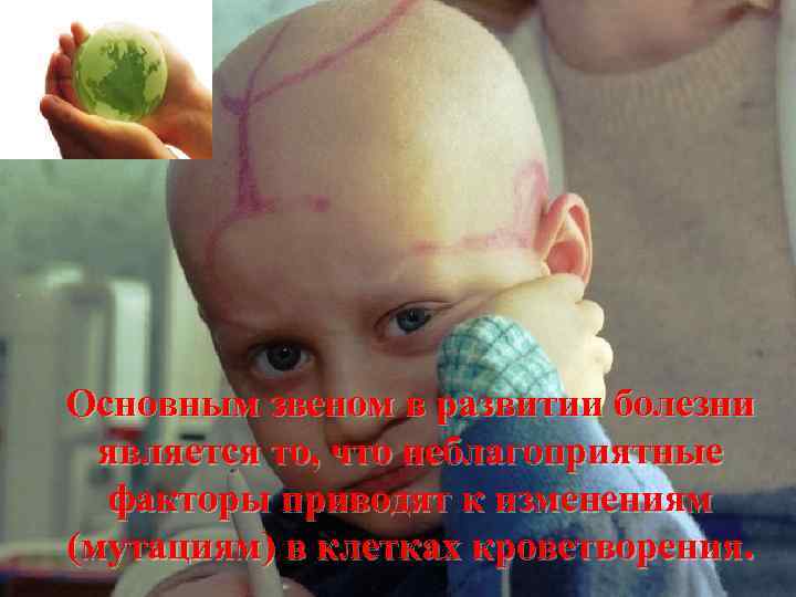 Основным звеном в развитии болезни является то, что неблагоприятные факторы приводят к изменениям (мутациям)