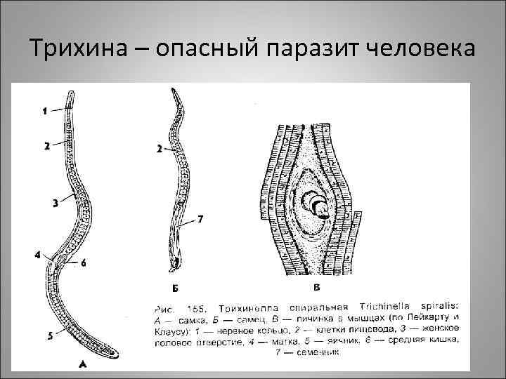 Трихина – опасный паразит человека 