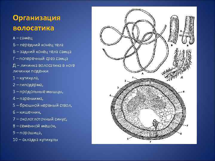 Организация волосатика А – самец Б – передний конец тела В – задний конец