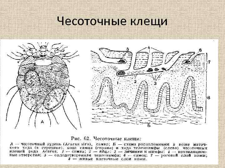 Чесоточные клещи 