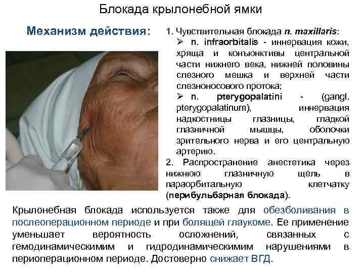 Блокада крылонебной ямки Механизм действия: 1. Чувствительная блокада n. maxillaris: Ø n. infraorbitalis -