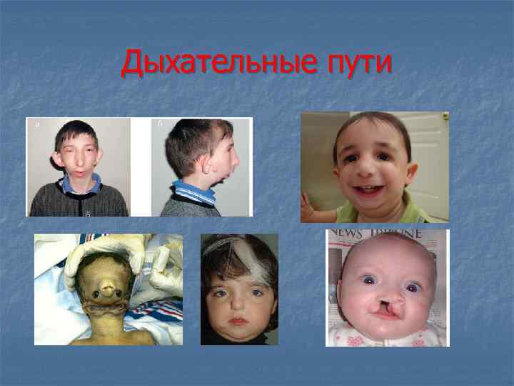 Дыхательные пути 