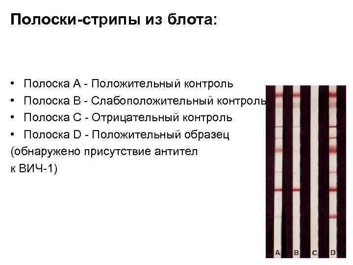 Полоски-стрипы из блота: • Полоска А - Положительный контроль • Полоска В - Слабоположительный