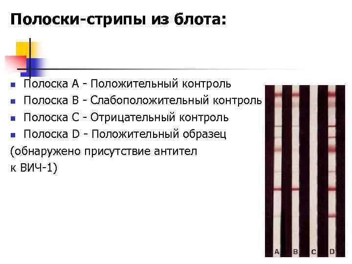 Полоски-стрипы из блота: Полоска А - Положительный контроль n Полоска В - Слабоположительный контроль