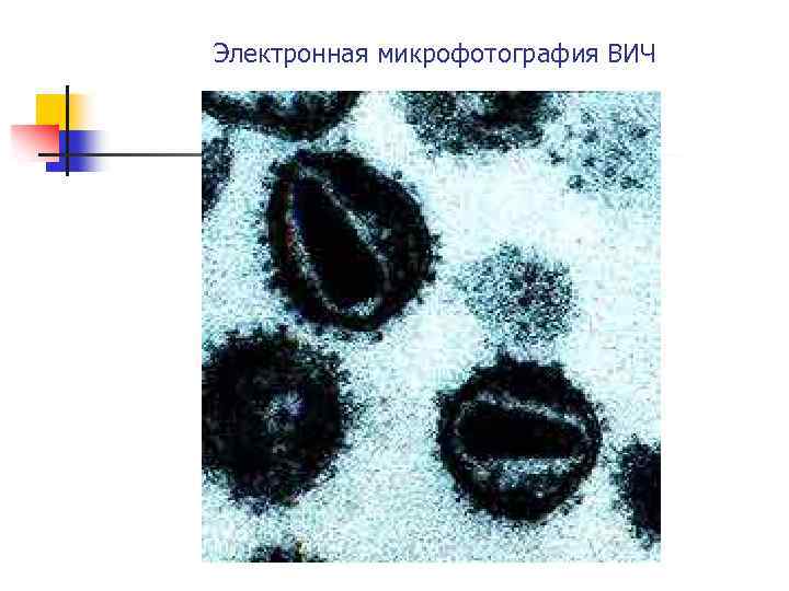 Электронная микрофотография ВИЧ 
