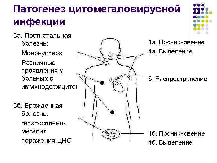 Патогенез цитомегаловирусной инфекции 3 а. Постнатальная болезнь: Мононуклеоз Различные проявления у больных с иммунодефицитом