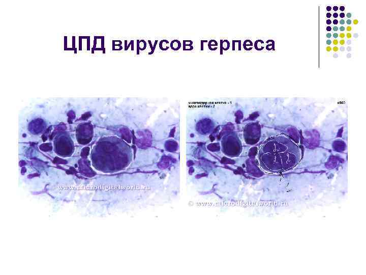 Цпд вируса это. ЦПД вирусов микробиология. ЦПД вируса простого герпеса. Цитопатическое действие вирусов.