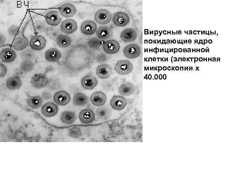 Вирусные частицы, покидающие ядро инфицированной клетки (электронная микроскопия х 40. 000 