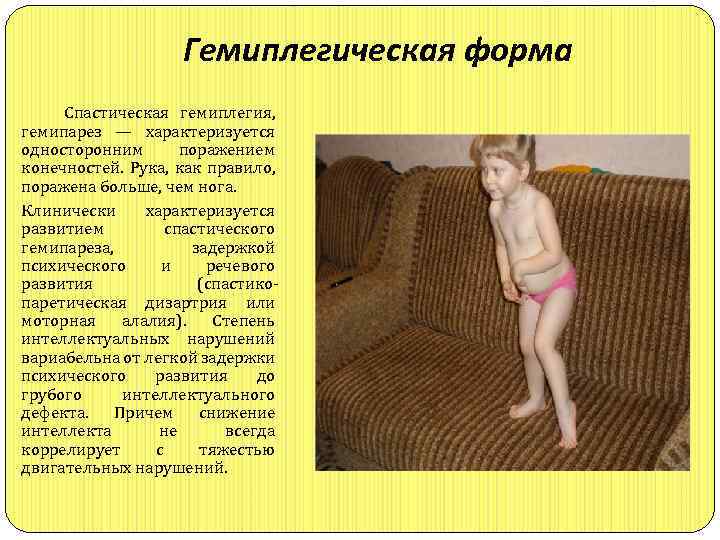 Гемиплегическая форма Cпастическая гемиплегия, гемипарез — характеризуется односторонним поражением конечностей. Рука, как правило, поражена
