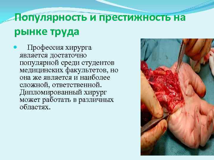 Популярность и престижность на рынке труда Профессия хирурга является достаточно популярной среди студентов медицинских