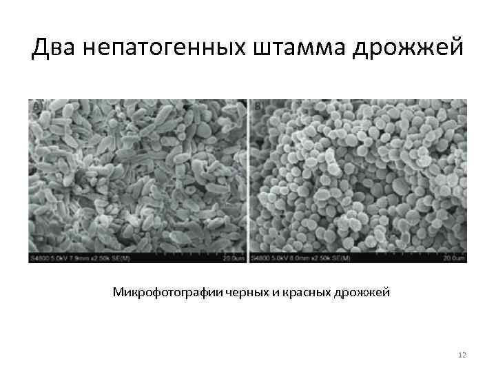 Два непатогенных штамма дрожжей Микрофотографии черных и красных дрожжей 12 