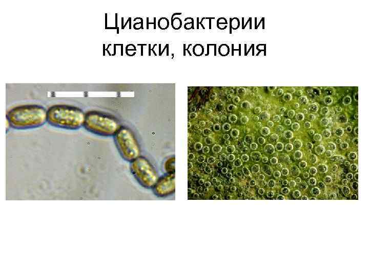 Цианобактерии клетки, колония 