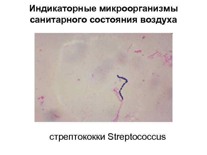 Индикаторные микроорганизмы санитарного состояния воздуха стрептококки Streptococcus 